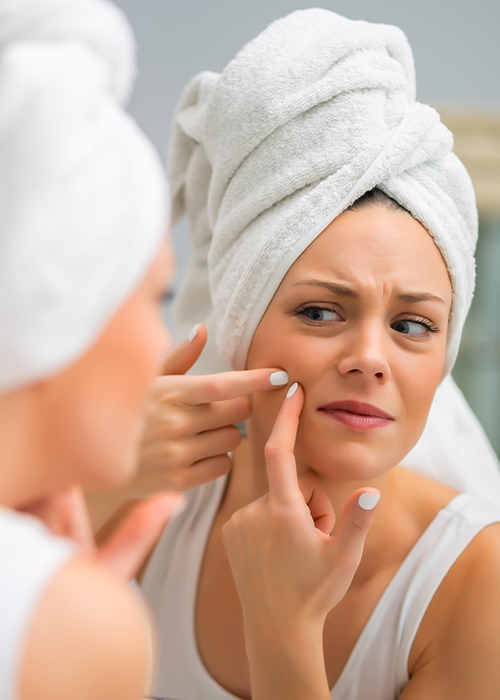 Acne-antes-despues-medellin