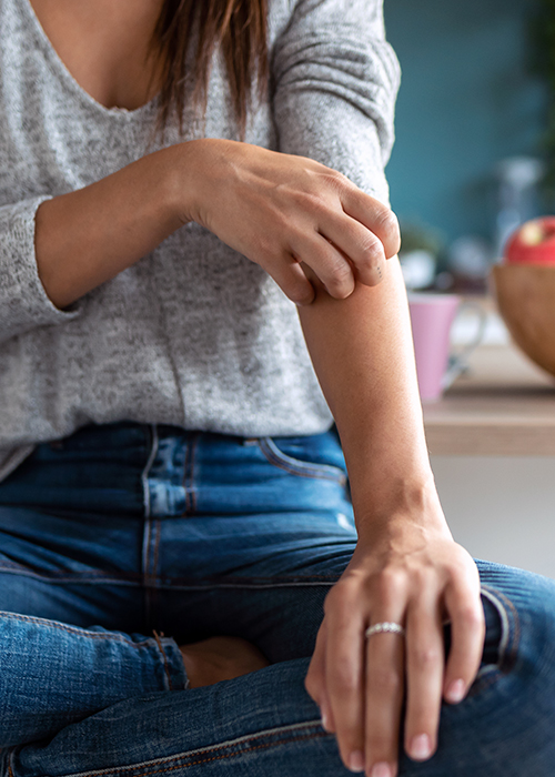 Dermatitis-atopica